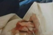 我和男友吵架后竟然自残！（探讨心理问题背后的真相）